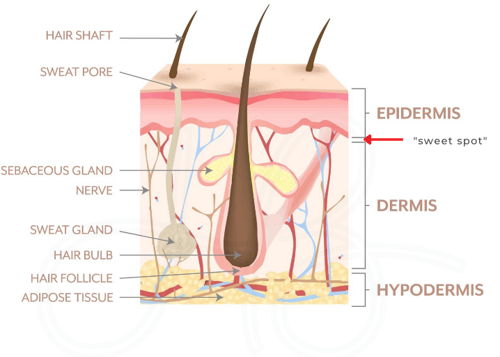 PMU: Is it Permanent or Semi-Permanent?